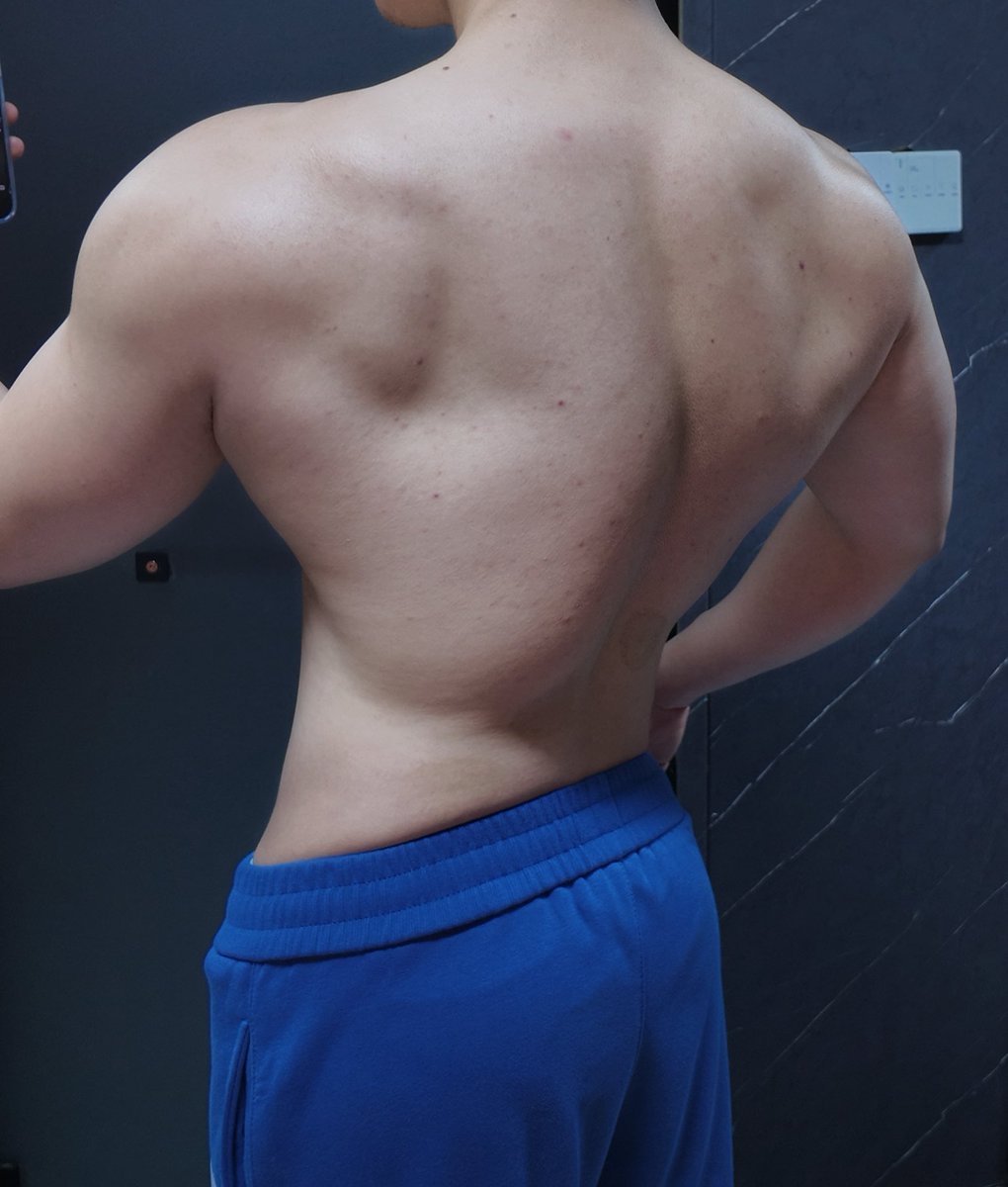 Anthurism tweet media