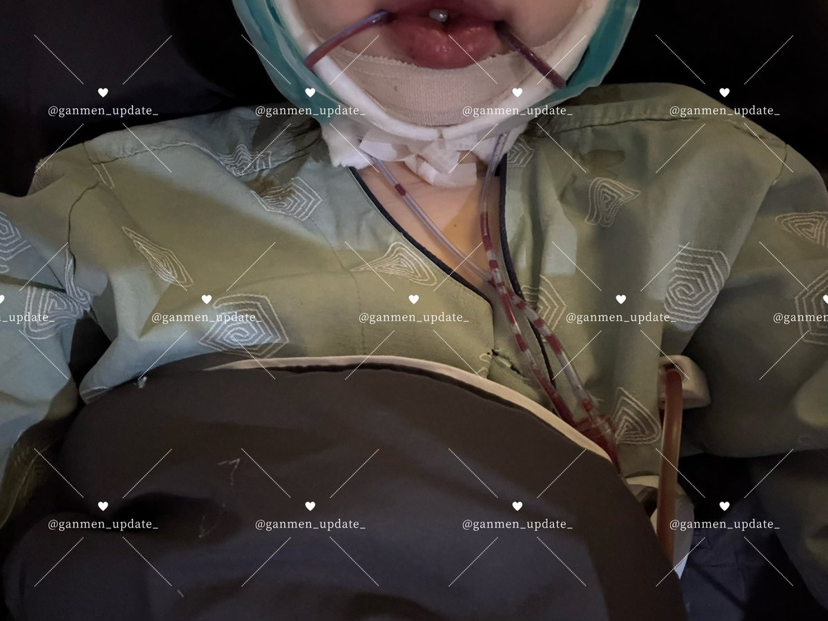 みょん◡̈【輪郭3点+目頭目尻タレ目DT中🏥】整形匿名タレコミ質問募集中 tweet media