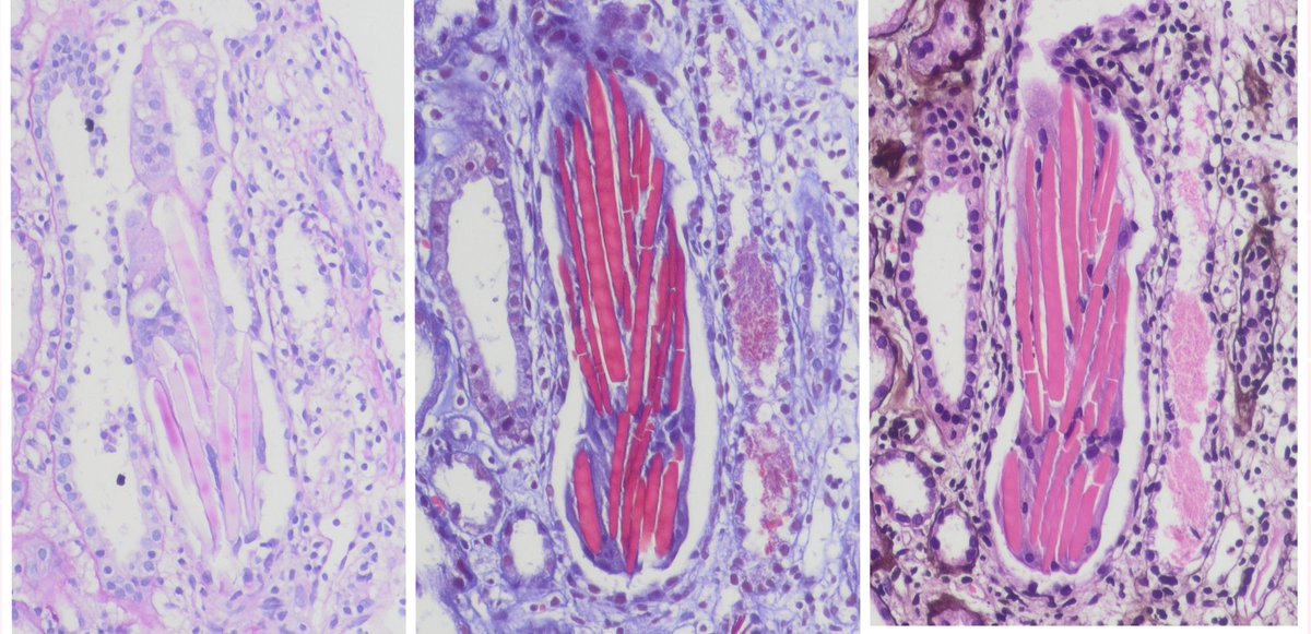 Mahesha Vankalakunti 🇮🇳 tweet media