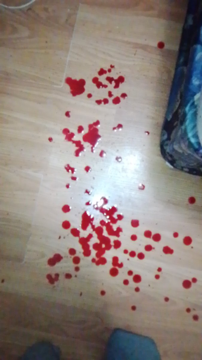 Simon of shedtwt tweet media