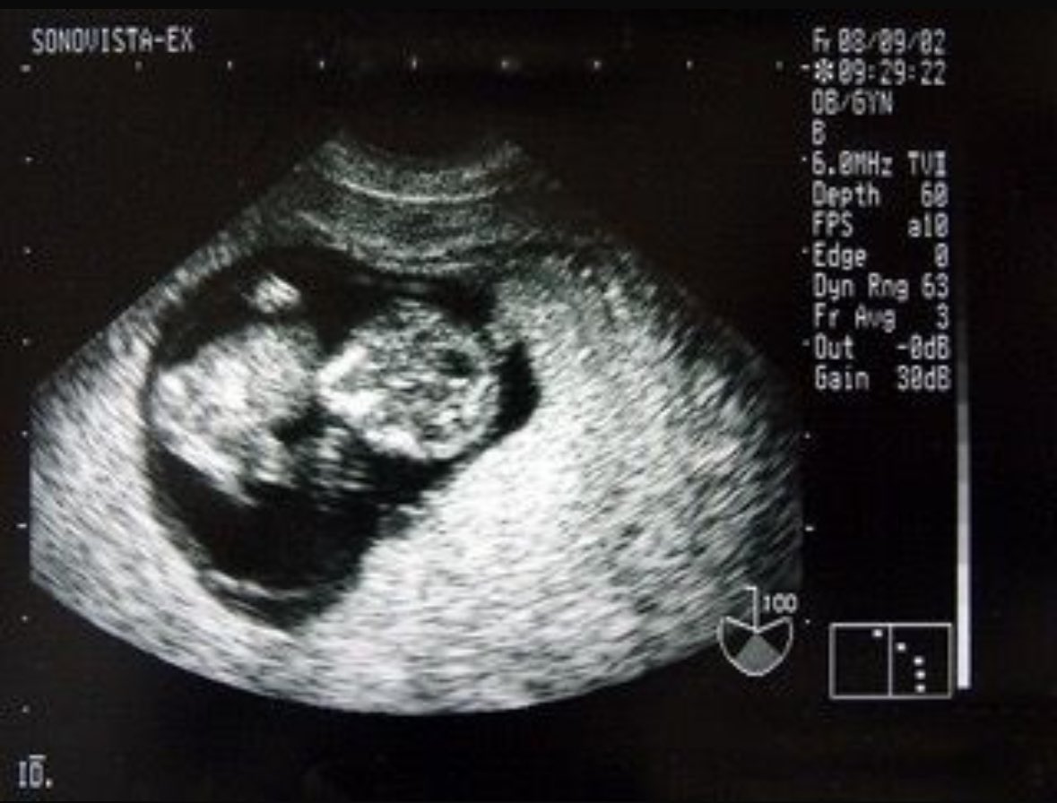 YannouShow tweet media