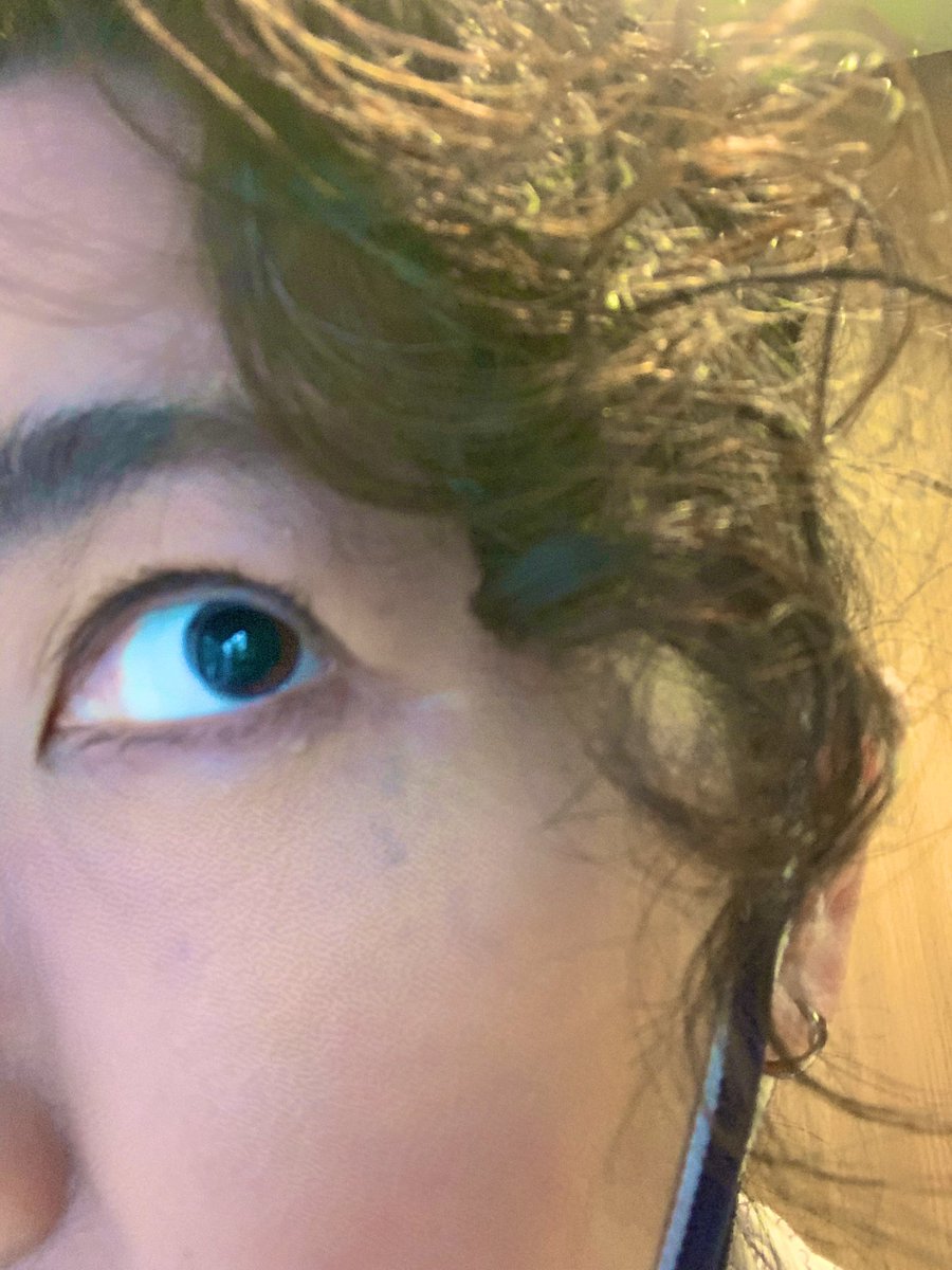 お分かりいただけるだろうか…ｳﾌﾌﾌ…Bowie様とお揃い…🤤
(眼底検査により瞳孔散大)