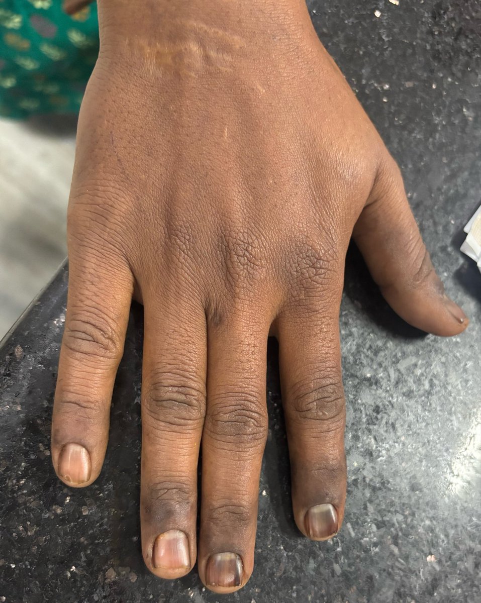 Aravind Palraj tweet media