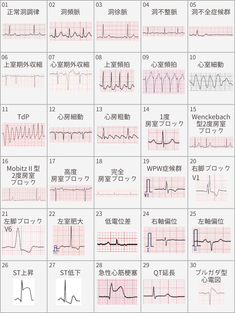 心電図くま | ECG KUMA tweet media
