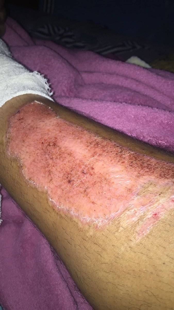 USER DIED tweet media