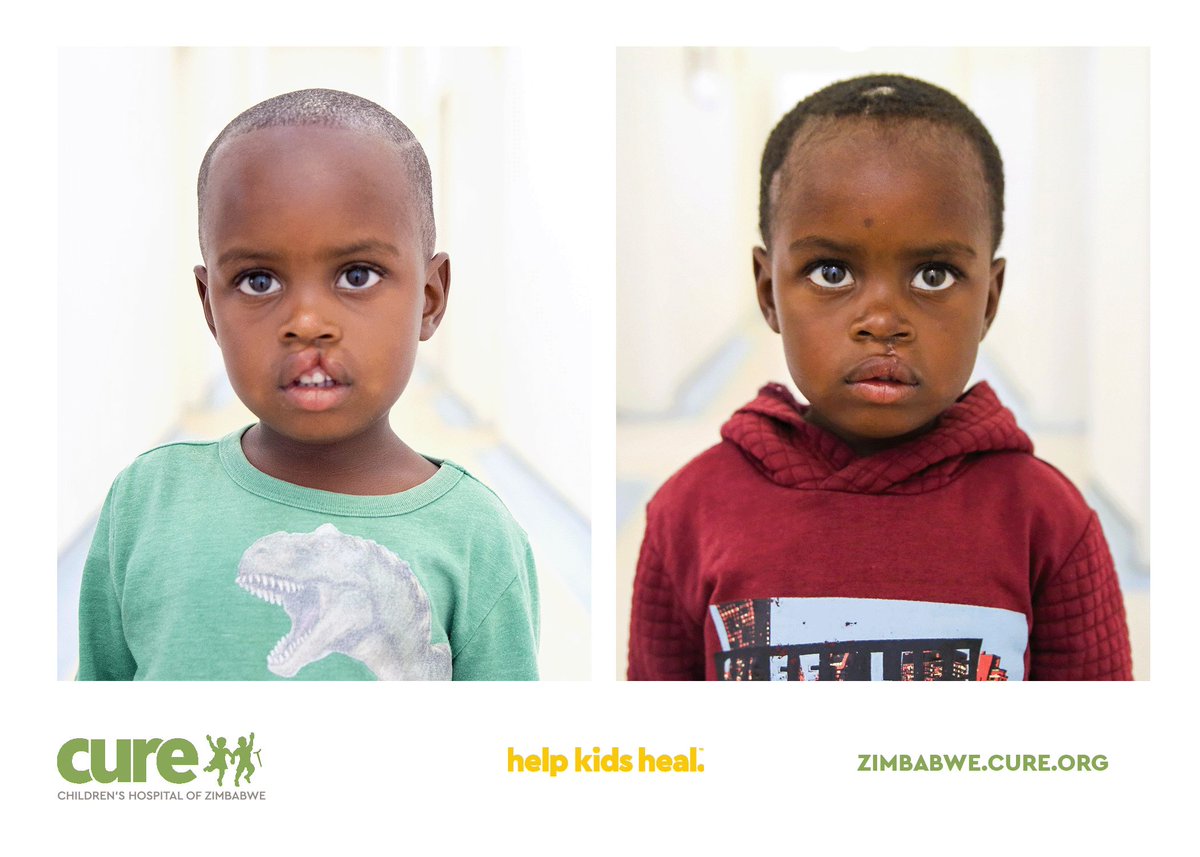 CURE Children's Hospital of Zimbabwe tweet media