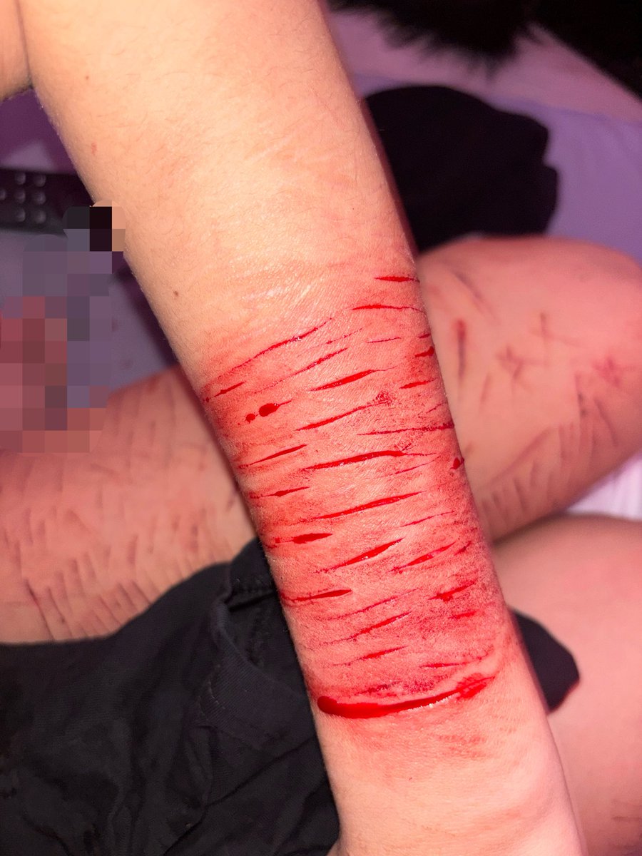 ˚⋆𐙚｡Kirumi of shedtwt 𖦹.ᡣ𐭩˚ tweet media