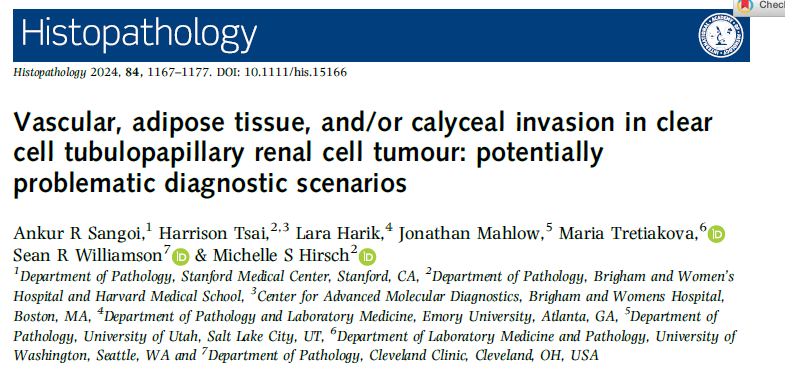 slusagar's tweet photo. while not formally staged since not "carcinoma", rarely can you get "pT3a" histology🔬
(vascular/adipose/pelvicalyceal invasion)

doesn't change Dx!  
(but if occurs, probably worth confirming Dx by doing NGS to rule out DDx entities)

PMID: 38422612 https://t.co/PepDnQ4mLF
