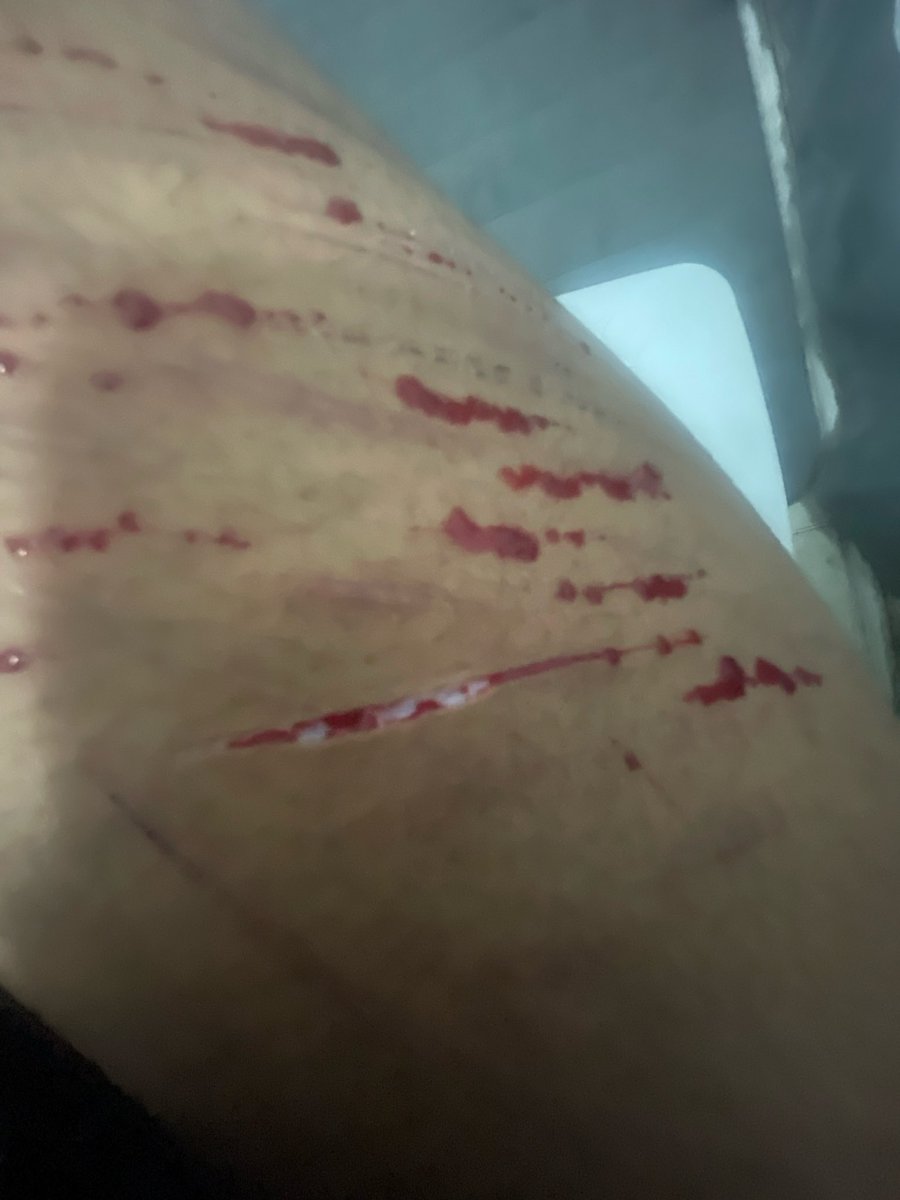 princess of shedtwt and drugtwt tweet media