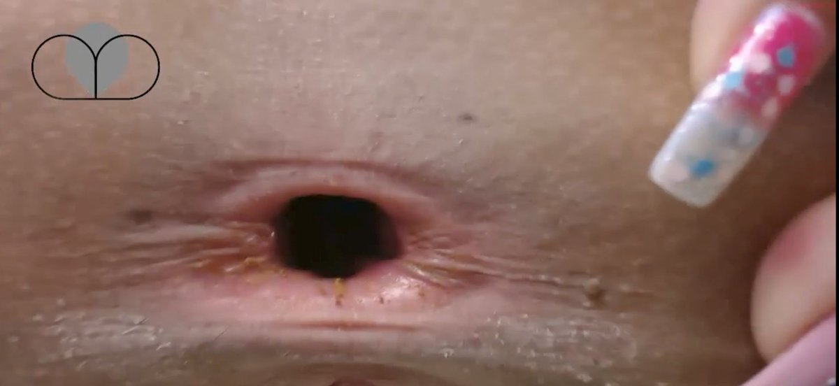 GapesGoneWild tweet media