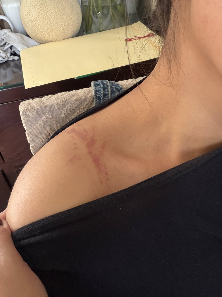 cabrones, nomas por llevar cargando las compras del Walmart hasta mi casa, de bajo del pinche sol me dolió la cabeza y la panza todo el día, en un día de chamba no la armo
