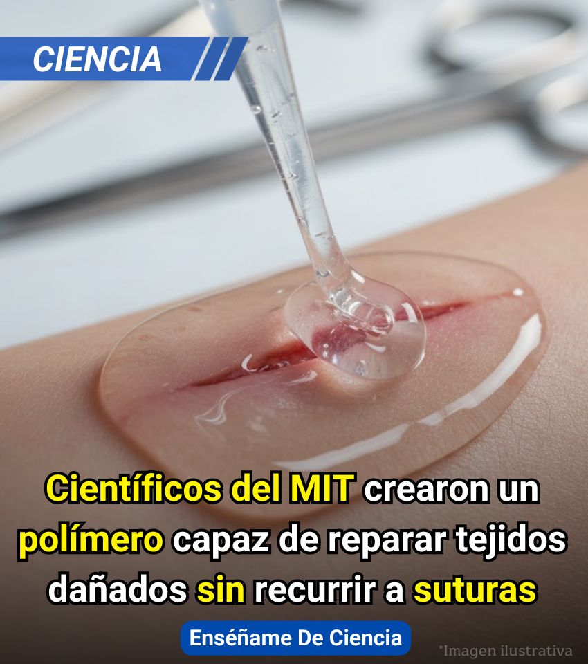 EnsedeCiencia's tweet photo. 🔴Científicos del Instituto Tecnológico de Massachussets desarrollaron un innovador método con el que se podrán reparar los tejidos sin necesidad de cirugía. Se trata de un polímero que hará posible una reparación de tejidos sin recurrir a las suturas, grapas o mallas. https://t.co/N0Dcdl2YHv