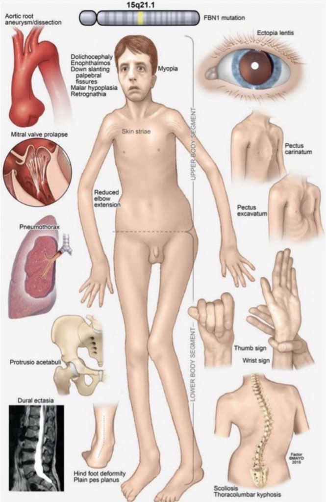 Lennart🇩🇪 tweet media