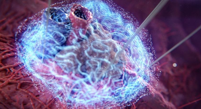 Medical Product Outsourcing tweet media