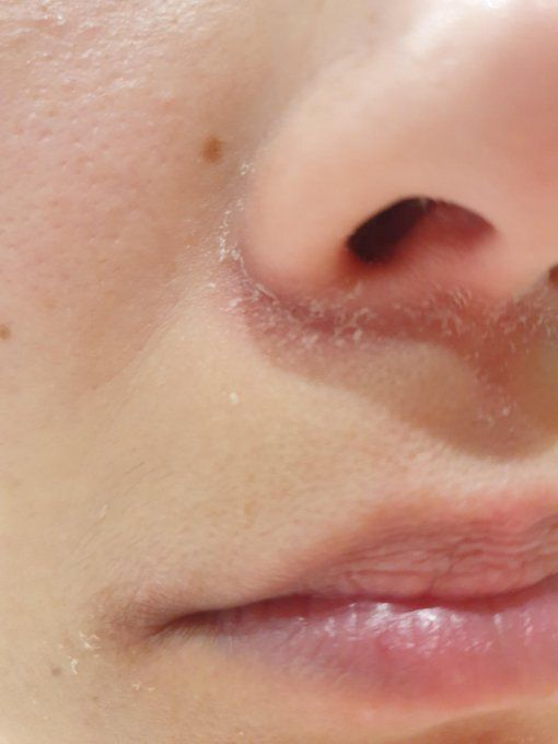 مُستثنى tweet media