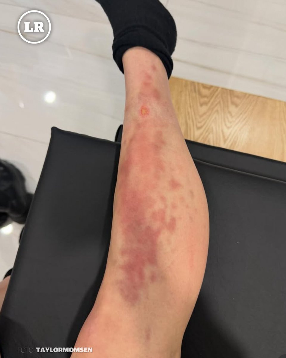 LaRazon_mx's tweet image. Angus Young y Brian Johnson encabezaron el espectáculo en el Estadio GNP mientras la artista reportó un estado de salud estable 🕷️🏥🎸 #TaylorMomsen #ACDC #EstadioGNP