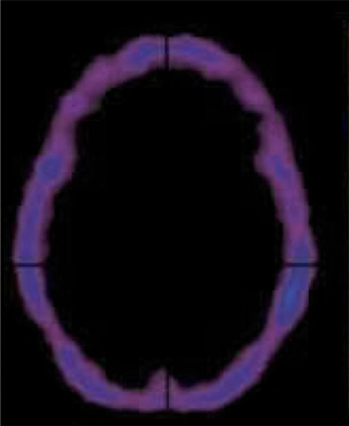 Matthew Linder tweet media