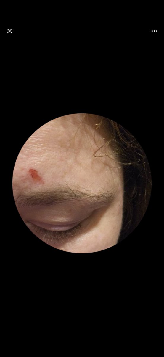 BLACK WIDOW🕸️🕷️🩷 tweet media