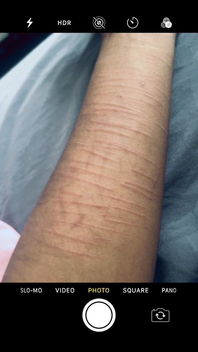 Taytayy_20's tweet image. Kinda cute ngl 

#shtwt
#selfharm
#cuts