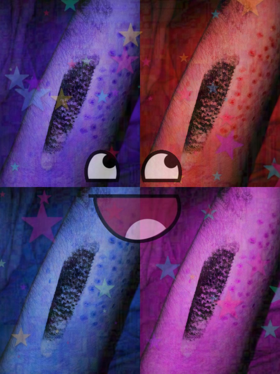 burnadd1ct's tweet image. Big burn, meow #sh #shtwt