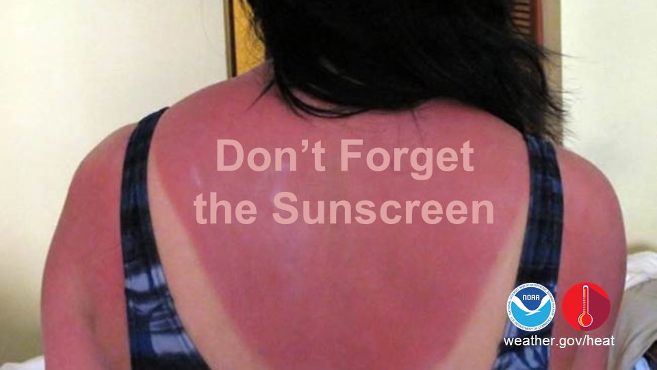 NWSNewOrleans's tweet image. Spending time in the sun? Apply sunscreen and avoid heat-related illness: weather.gov/heat #HeatSafety