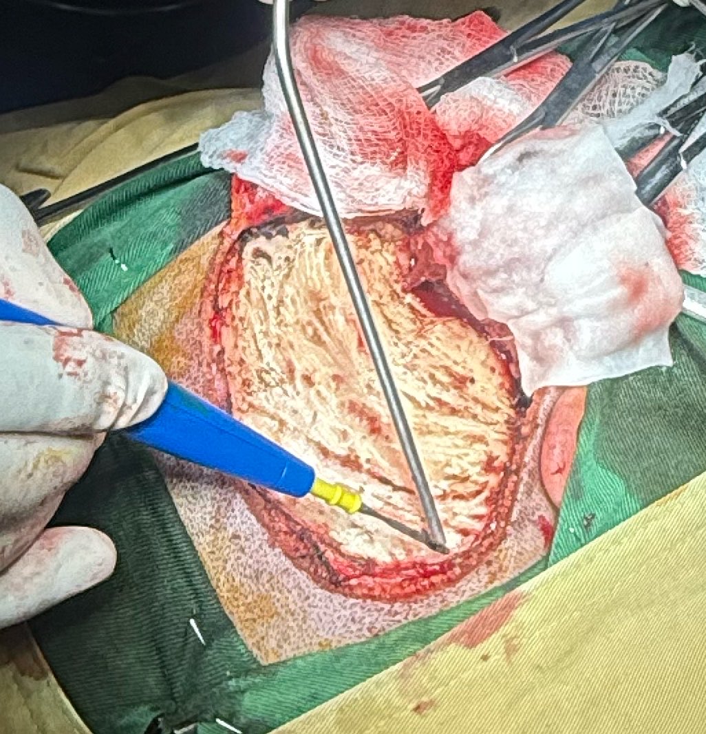 KK Zadran tweet media