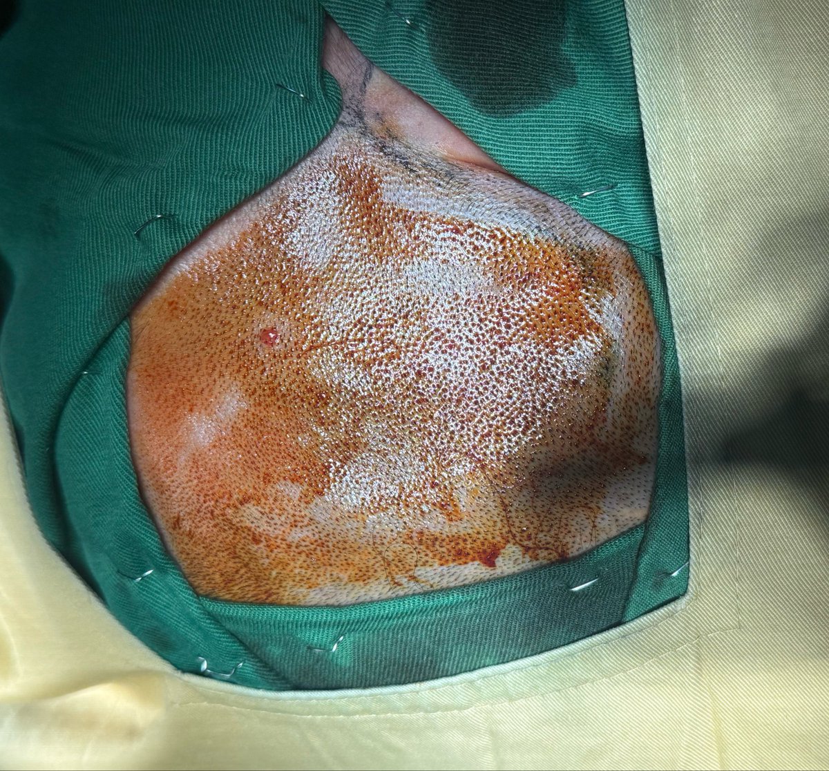 KK Zadran tweet media