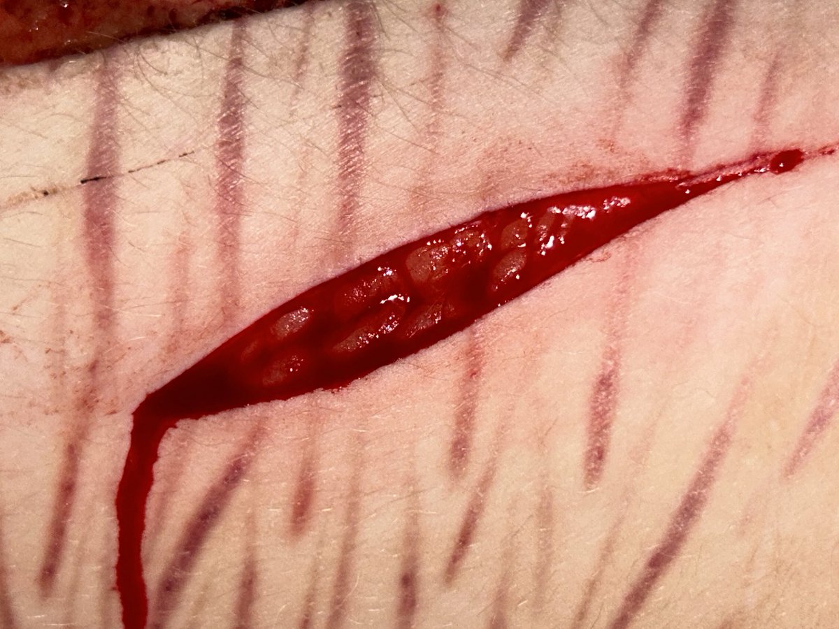 ✚┆maple of shedtwt tweet media