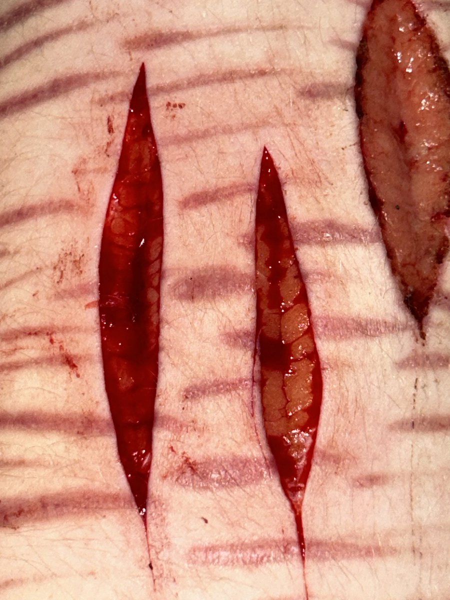 ✚┆maple of shedtwt tweet media