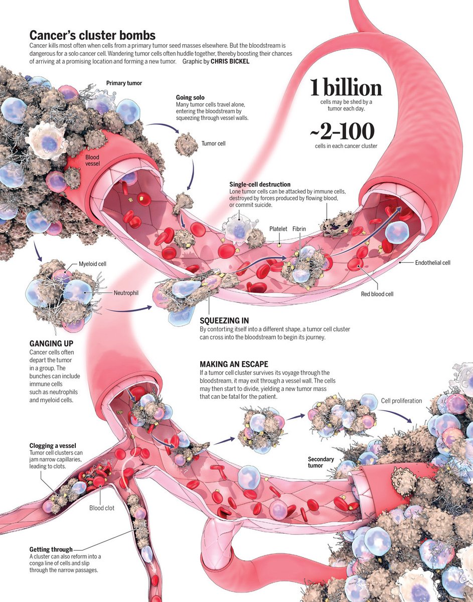 ScienceMagazine's tweet image. Tumor cells often metastasize in clusters with other cells, offering novel targets for treatments.

Learn more: scim.ag/4dF9dui @NewsfromScience