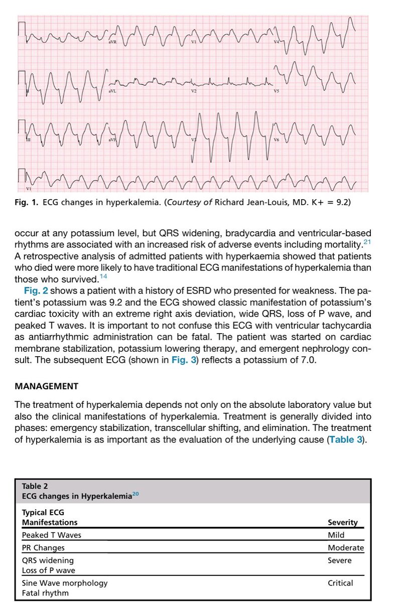 rksanti's tweet photo. 🩺Trastornos del Potasio (2026), ideal para refrescar conceptos clave en Urgencias y Medicina Interna. 📚✨
 🧵 HILO: Diskalemias (Hiper e Hipopotasemia) 🧬
1⃣/10 Los trastornos del potasio son el "pan de cada día" en Urgencias: ¡hasta 1 de cada 11 pacientes presenta alteraciones!. No son solo números; son reflejos de patologías subyacentes o interacciones medicamentosas críticas.
2⃣/10 HIPERPOTASEMIA ⚠️ (K^+ > 5.0~mmol/L):
¡Cuidado con la pseudo-hiperpotasemia! Hemólisis por torniquete prolongado o fragilidad celular en leucemias pueden dar falsos positivos. Siempre correlacionar con el EKG antes de actuar agresivamente.
3⃣/10 El EKG no es perfecto (puede fallar en el 50% de los casos), pero cuando avisa, el riesgo es alto.
📈 Progresión clásica:
 1. Ondas T picudas (Leve)
 2. Cambios en PR (Moderado)
 3. QRS ancho / Pérdida de P (Severo)
 4. Onda sinusoidal (Crítico)
4⃣/10 Manejo de Hiperpotasemia en 3 pasos:
1️⃣ Estabilización de membrana: Gluconato (2-3g) o Cloruro de Calcio (1-2g). ¡Vital si hay cambios en el EKG!.
2️⃣ Redistribución: Insulina IV + Glucosa (ojo con la hipoglucemia, monitorizar 6h) y Albuterol nebulizado.
3️⃣ Eliminación: Diuréticos de asa o nuevos quelantes como el Ciclosilicato de Zirconio Sodio.
5⃣/10 SÍNDROME BRASH 💓🐢:
Una combinación letal: Bradicardia, Renal failure (Falla renal), AV blockade, Shock e Hiperpotasemia. Se crea un círculo vicioso donde cada factor empeora al otro. ¡Manejo agresivo y adrenalina pueden ser necesarios!.
6⃣/10 HIPOPOTASEMIA 📉 (K^+ < 3.5~mmol/L):
A menudo subestimada, pero presente en hasta el 20% de hospitalizados.
🚩 Clínica: Debilidad muscular profunda, calambres, palpitaciones y riesgo de Torsade de Pointes.
7⃣/10 EKG en Hipopotasemia:
 ✅Aplanamiento de onda T.
 ✅Depresión del ST.
 ✅Ondas U (deflexión positiva tras la T).
✅Ondas de Nikelekam: T invertida seguida de una gran onda U (¡signo de alarma!).
8⃣/10 Tratamiento de Hipopotasemia 💊:
¡La vía ORAL es la reina! Es más segura y eficiente para entregar grandes cantidades.
⚠️ Tip de oro: Si el potasio no sube, ¡revisa el Magnesio! La hipomagnesemia impide que el cuerpo retenga el potasio repuesto.
9⃣/10 Poblaciones Especiales - DKA🩺:
En la Cetoacidosis Diabética, el potasio total está DEPLECIONADO aunque el nivel sérico parezca normal. Iniciar insulina sin corregir el potasio puede ser catastrófico.
1⃣0⃣/10 ¡Mantente actualizado para salvar vidas! 🚀 Sígueme aquí en X como @rksanti
🔗 ¿Quieres el PDF completo y más artículos analizados?
Únete al grupo de Telegram:
👉 https://t.co/8UCjian2vV
#Medicina #Urgencias #InternalMedicine