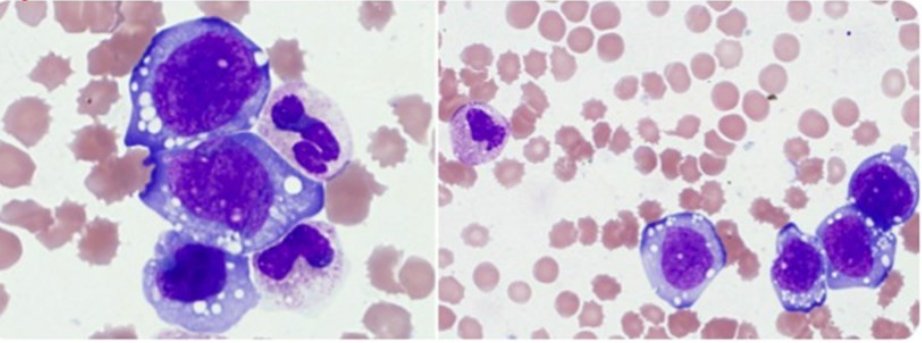 Benlazar S M A tweet media