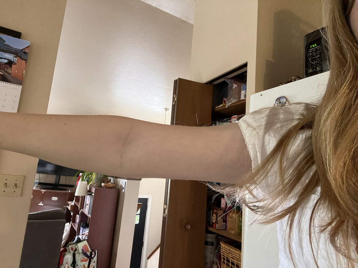 oatkgs's tweet image. why  is  my  arm  so  fat  #kms