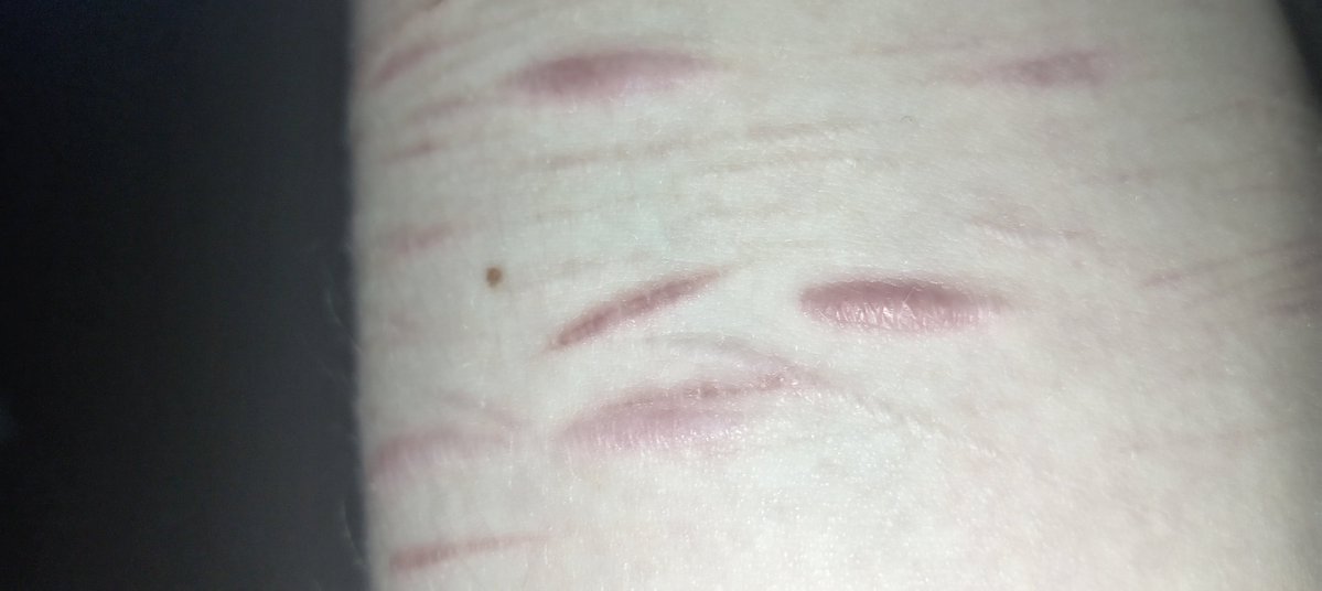 N0TKlRA's tweet image. scars