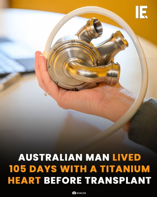 IntEngineering's tweet image. An Australian man in his 40s became the first person to leave hospital powered entirely by a BiVACOR Total Artificial Heart. Implanted at St Vincent’s Sydney in November 2024, the titanium device ran nonstop for 105 days until he received a donor heart in March 2025. Using a