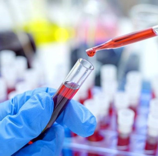 CURARON A UN PACIENTE CON VIH TRAS UN TRASPLANTE DE CÉLULAS MADRE

Un hombre de 63 años logró la remisión del VIH tras recibir un trasplante en 2020 para tratar un cáncer de sangre. Dejó el tratamiento antirretroviral hace dos años y a los cuatro años de esa retirada sigue sin