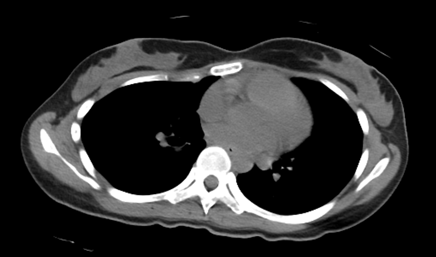 貌鳥D型(寒冷地仕様) tweet media