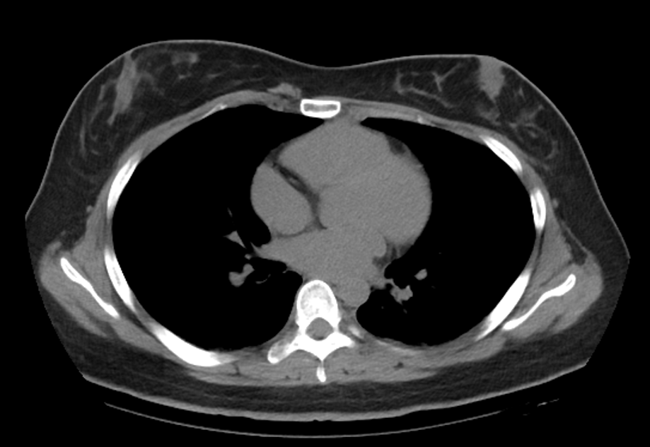 貌鳥D型(寒冷地仕様) tweet media