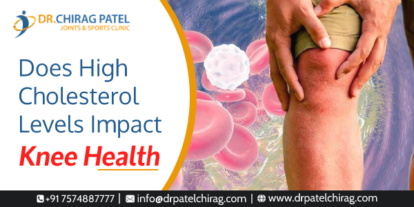 Why High Cholesterol is Bad for Health?

Cholesterol circulates in the body along with the blood. When the cholesterol level increases beyond what is necessary it tends to interfere with the regular functioning of the vital organs...

drpatelchirag.com/blog/does-high…