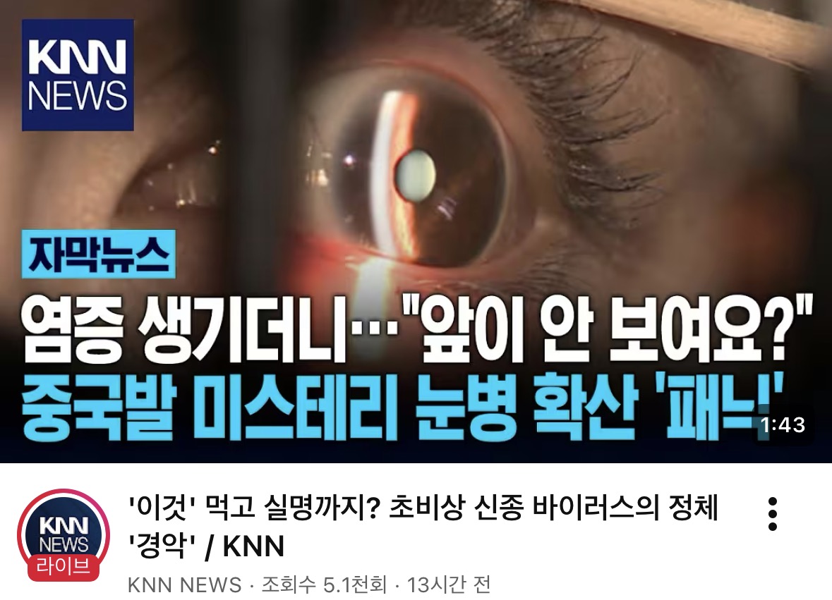 장코드 tweet media