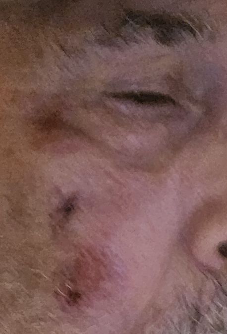 🇺🇸 Grant 🇺🇸 tweet media