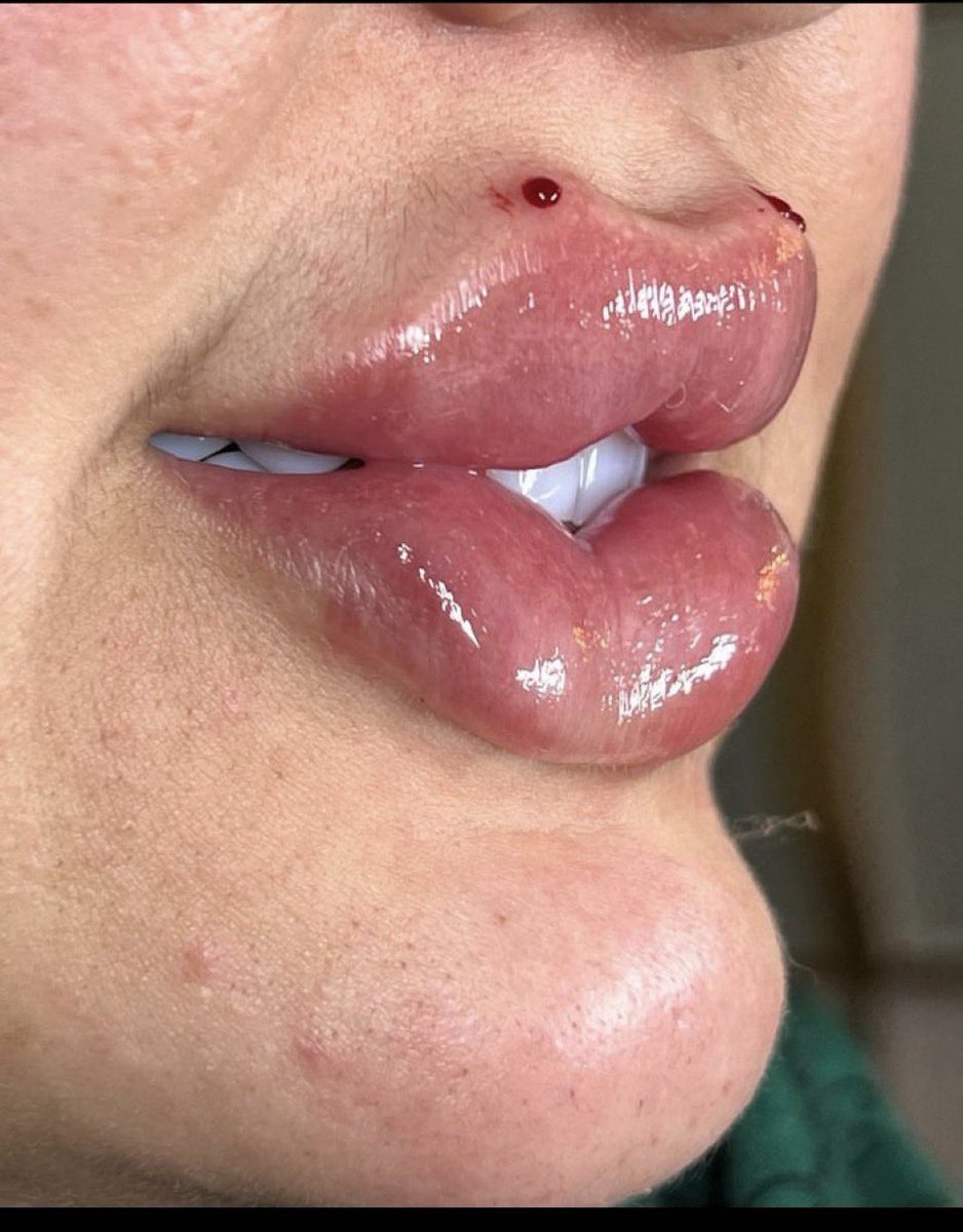 كنداكة ☕ tweet media