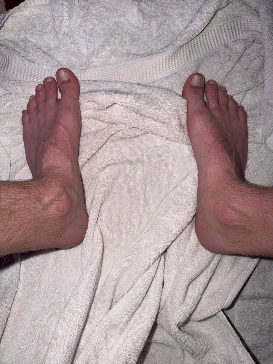 British Ginger Size 13’s tweet media