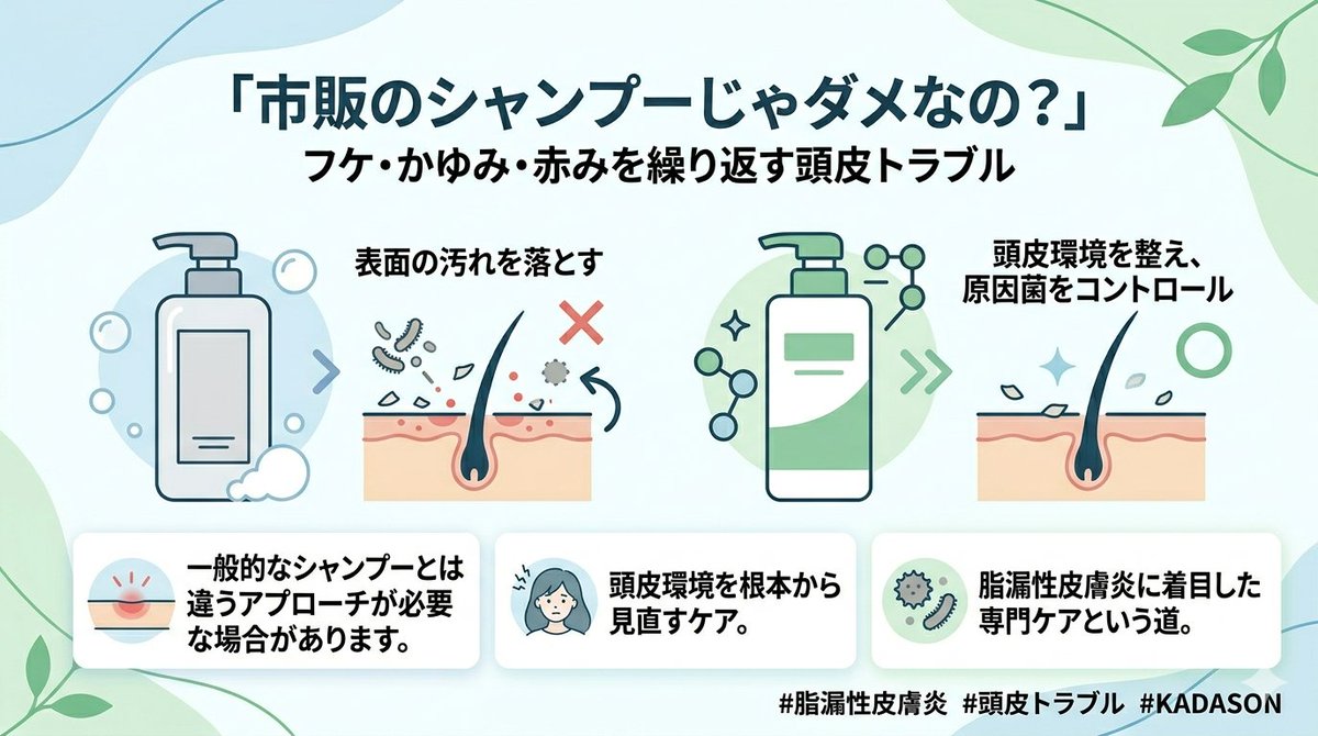 KADASON_ys's tweet photo. 「市販のシャンプーじゃダメなの？」
フケ・かゆみ・赤みを繰り返す頭皮トラブル。
実は一般的なシャンプーとは違うアプローチが必要な場合も💦
誰にも言えずに悩まないで。私たちがお手伝いできるかもしれません🧑‍⚕️
#脂漏性皮膚炎 #頭皮トラブル #KADASON https://t.co/ZbR0ZFz5cG