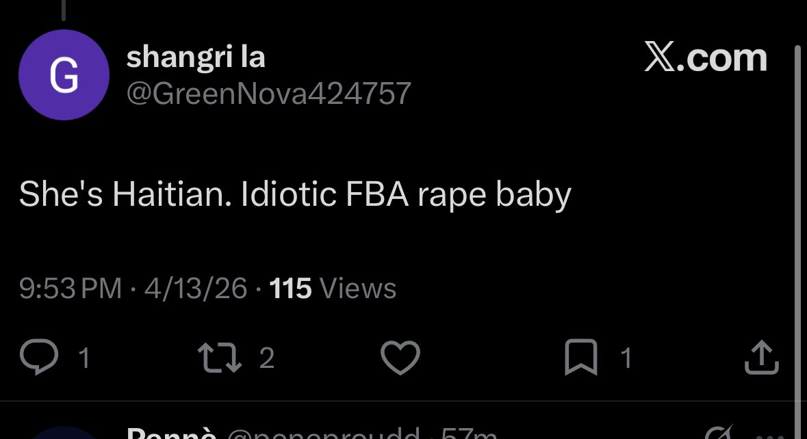 Lacefront wig glue detector tweet media