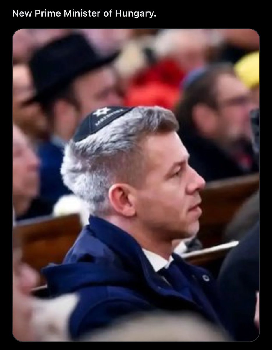 🦑 6'2 IQ144🔻 tweet media