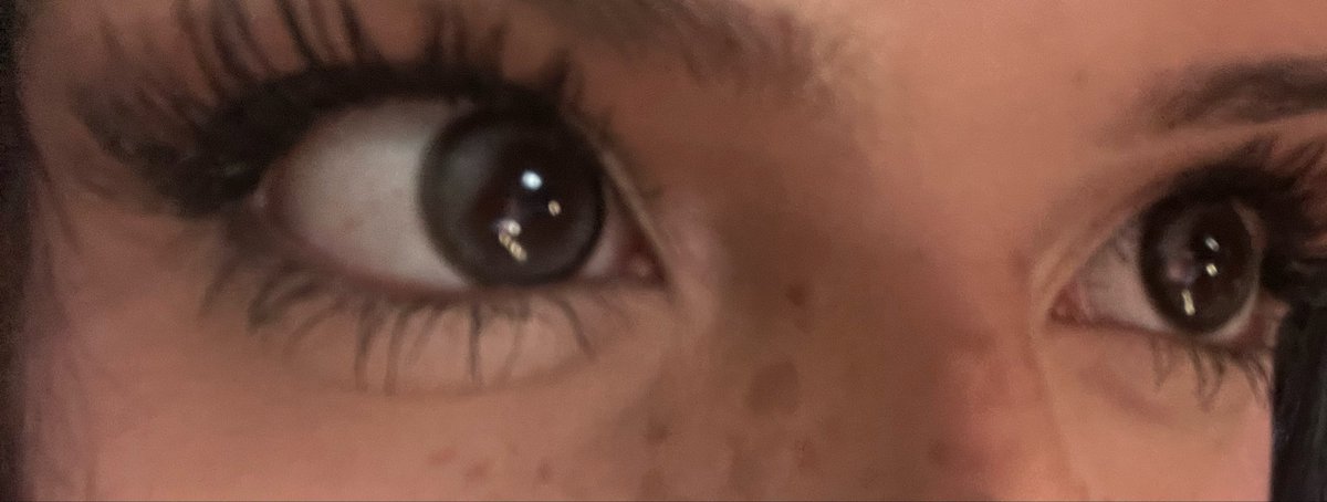 lobotomy tweet media