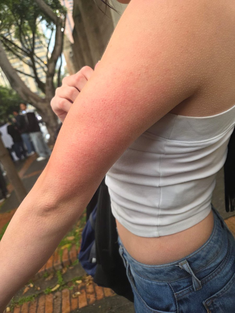 UcmcLucha's tweet photo. DENUNCIA PÚBLICA #sosunicolmayor @Bogota @CarlosFGalan Brutalidad en contra de los estudiantes de maneras absurdas y desmedidas.
@Mineducacion https://t.co/FVKP1vUqSw