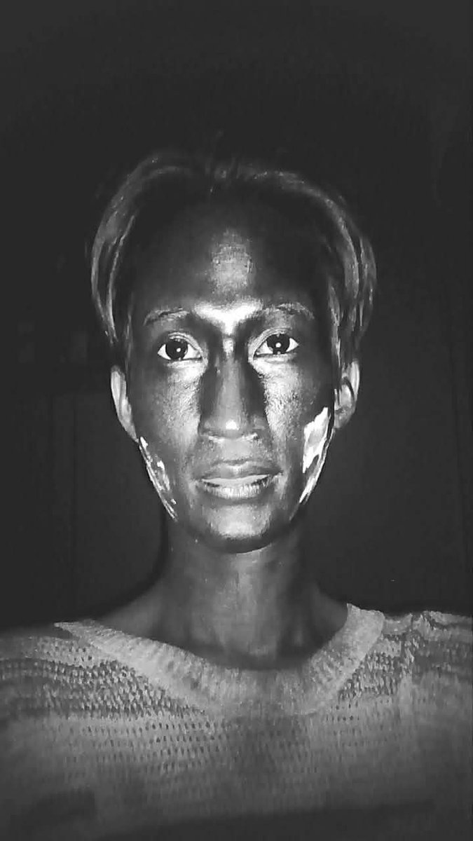 อย่าท้าทายระบบ

ใครทากันแดดแล้วชอบแสบตา

30 วัน 30 กันแดด

Day 13 L'Oreal Paris แถบแดง ที่สุดกันแดดหลักร้อย

ทากันแดดแล้วแสบตา ??

ง่ายสุด ยิ่งคนที่ผิวมัน เหงื่อเยอะ ให้ลงกันแดดแค่ 1 Step ตอนเช้า ลดโอกาสพวก Serum + น้ำตบ ไหลเข้าตา พวกนี้นอกจากสาร Active แล้วเค้ายังมีพวกตัวทำละลาย