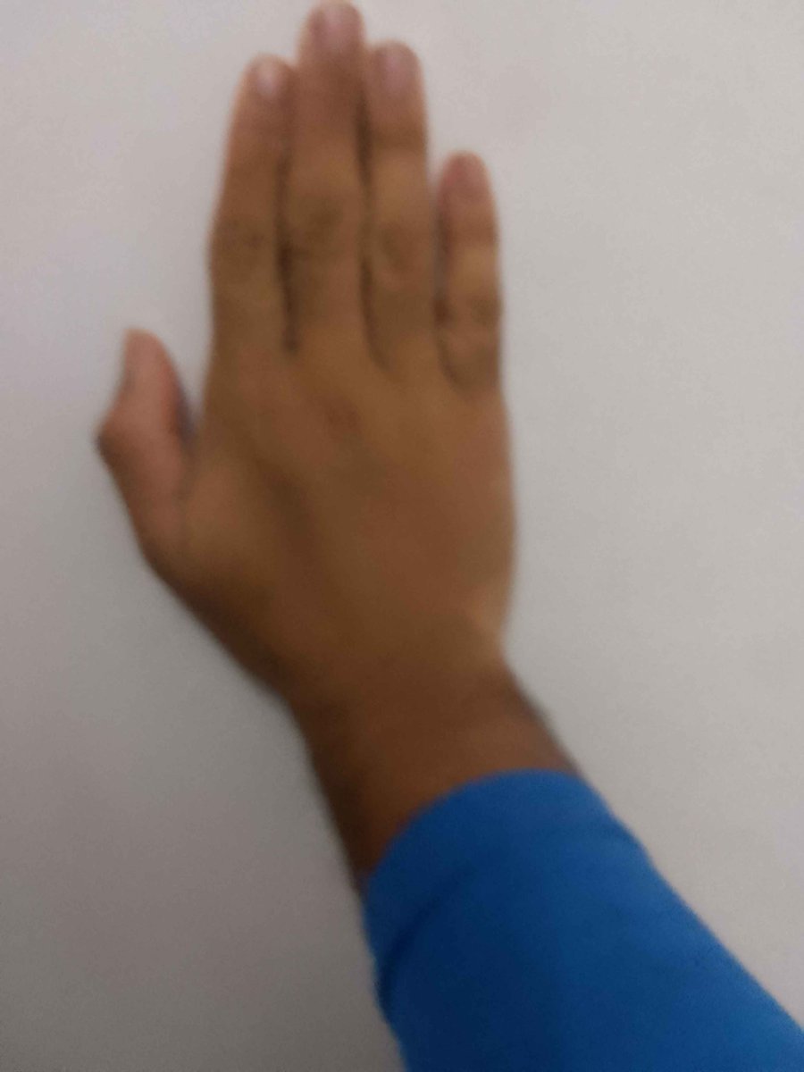 badassshaq's tweet photo. @DERABIGPOPPA @oelma__ similar to mine. If this information helps you, i think its called Fitzpatrick V. https://t.co/PpFqK9SFos